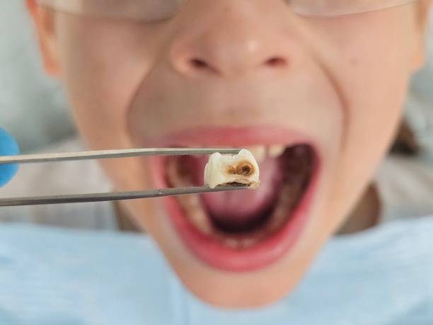 Best Emergency Dentist for Special Needs Patients in Shasta, CA